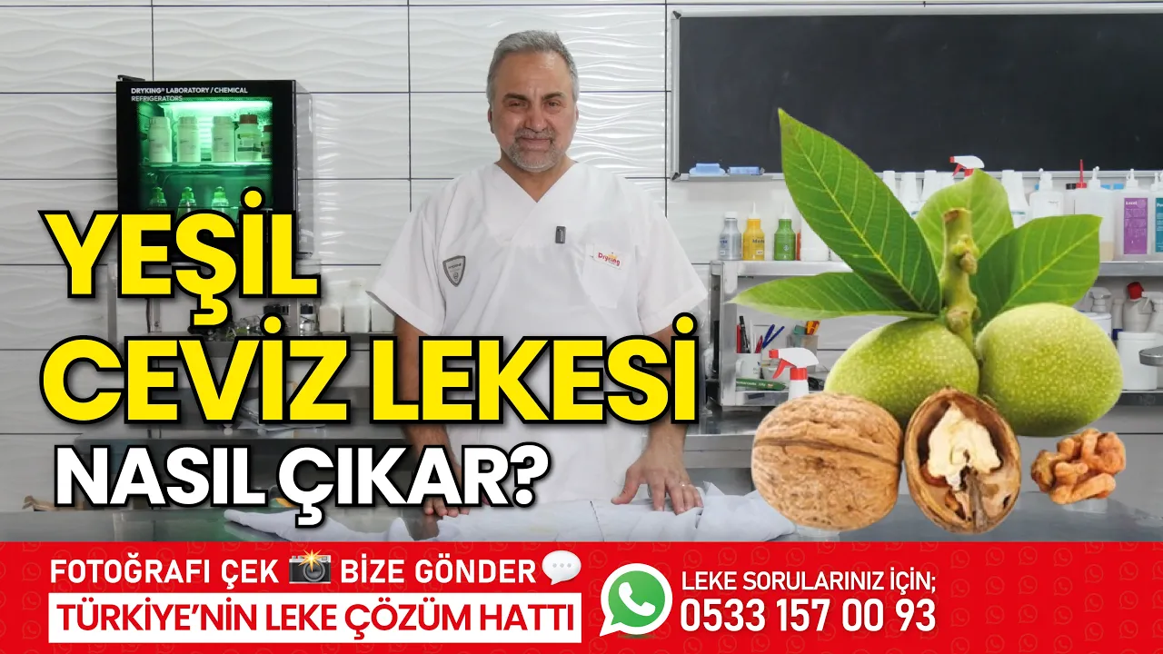 Yeşil Ceviz Lekesi Nasıl Çıkar?