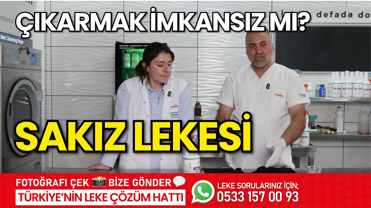 Sakız Lekesi Nasıl Çıkar?